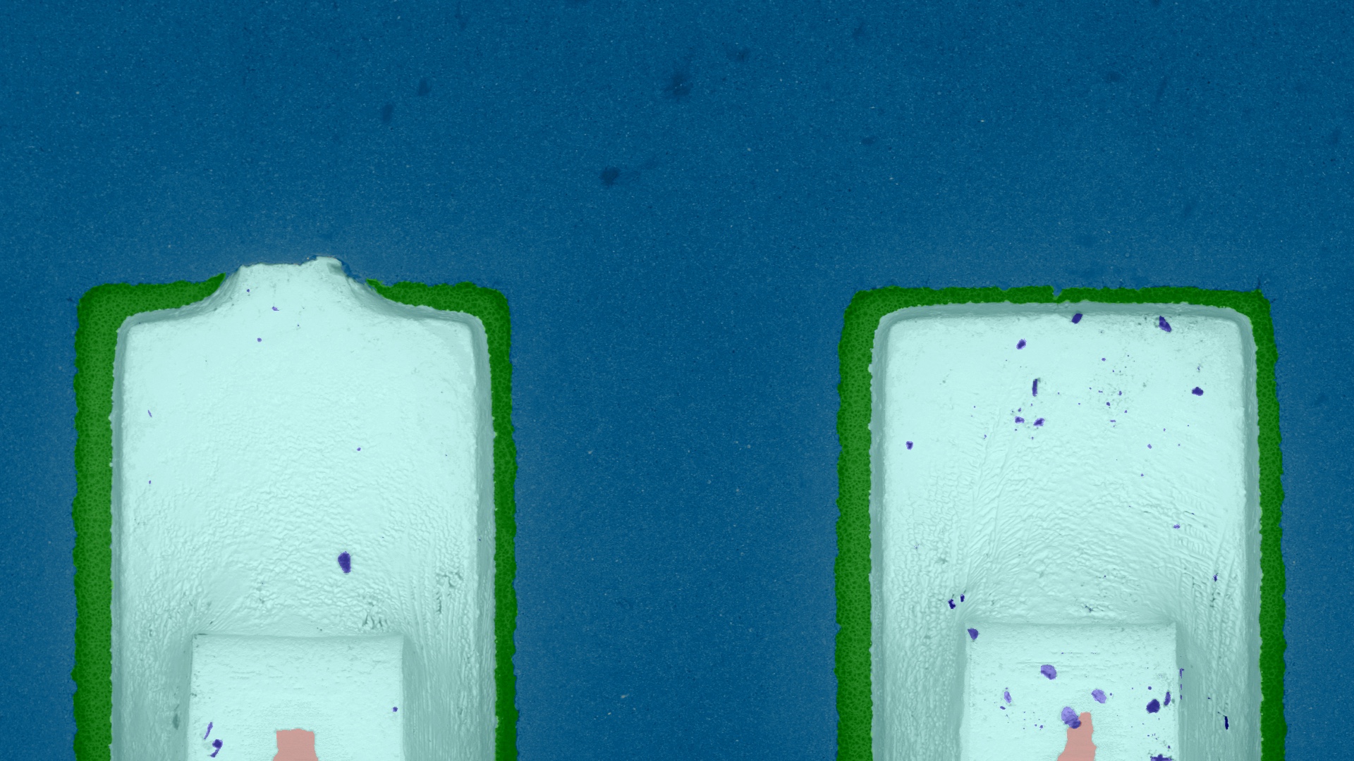 The challenge of image segmentation