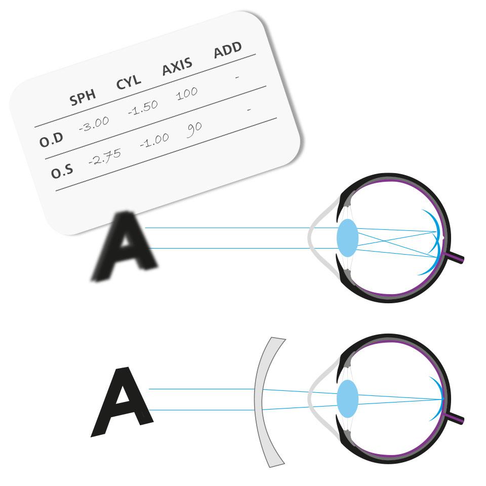 A prescription with numbers in the CYL and AXIS column